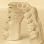 HIM DENTAL STONE CLASS III CREAM 1KG