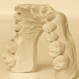HIM DENTAL STONE CLASS III CREAM 1KG