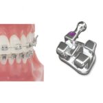 METAL BRACKETS ROTH