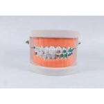 ORTHODONTIC STUDY MODEL