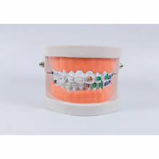 ORTHODONTIC STUDY MODEL
